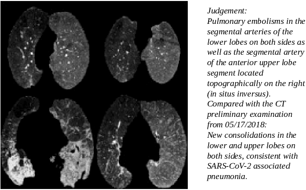Figure 1 for An Empirical Analysis for Zero-Shot Multi-Label Classification on COVID-19 CT Scans and Uncurated Reports