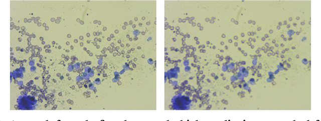 Figure 3 for Computer-Aided Cytology Diagnosis in Animals: CNN-Based Image Quality Assessment for Accurate Disease Classification