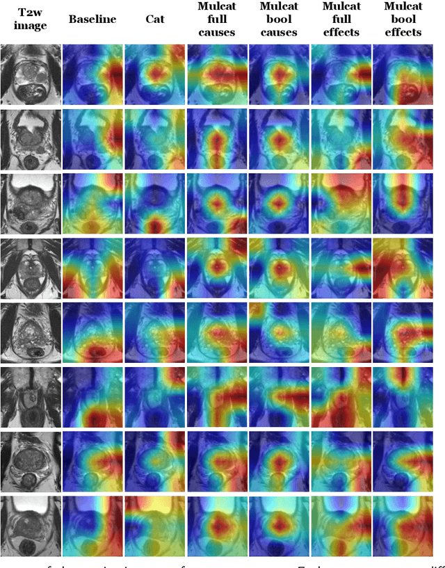 Figure 4 for Exploiting Causality Signals in Medical Images: A Pilot Study with Empirical Results