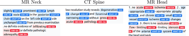 Figure 4 for Toward expanding the scope of radiology report summarization to multiple anatomies and modalities
