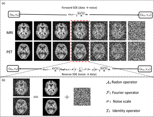 Figure 1 for Joint Diffusion: Mutual Consistency-Driven Diffusion Model for PET-MRI Co-Reconstruction