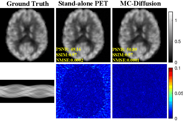 Figure 3 for Joint Diffusion: Mutual Consistency-Driven Diffusion Model for PET-MRI Co-Reconstruction
