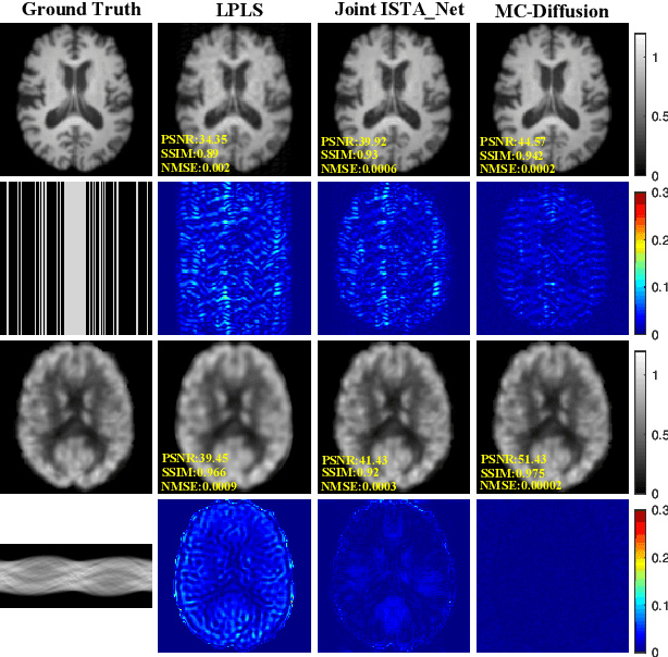 Figure 4 for Joint Diffusion: Mutual Consistency-Driven Diffusion Model for PET-MRI Co-Reconstruction