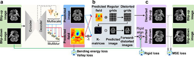 Figure 3 for FD-Net: An Unsupervised Deep Forward-Distortion Model for Susceptibility Artifact Correction in EPI