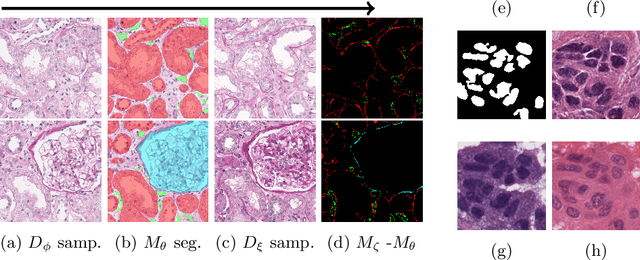 Figure 3 for Realistic Data Enrichment for Robust Image Segmentation in Histopathology