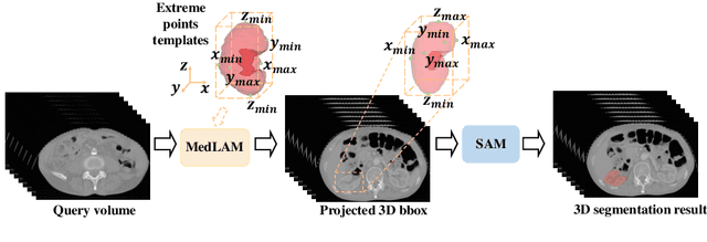 Figure 1 for MedLSAM: Localize and Segment Anything Model for 3D Medical Images