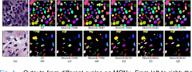 Figure 4 for Cyclic Learning: Bridging Image-level Labels and Nuclei Instance Segmentation