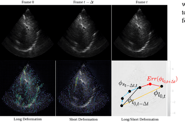 Figure 2 for LSDM: Long-Short Diffeomorphic Motion for Weakly-Supervised Ultrasound Landmark Tracking