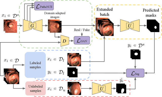 Figure 2 for Self-Supervised and Semi-Supervised Polyp Segmentation using Synthetic Data