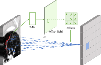 Figure 3 for Improved Focus on Hard Samples for Lung Nodule Detection