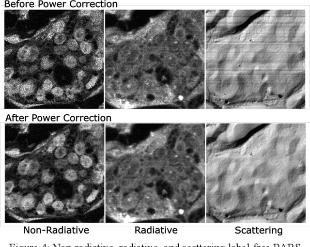 Figure 4 for Automated Whole Slide Imaging for Label-Free Histology using Photon Absorption Remote Sensing Microscopy