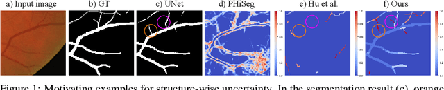 Figure 1 for Topology-Aware Uncertainty for Image Segmentation