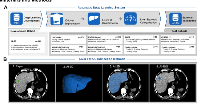 Figure 1 for Fully Automated Deep Learning-enabled Detection for Hepatic Steatosis on Computed Tomography: A Multicenter International Validation Study
