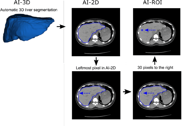 Figure 4 for Fully Automated Deep Learning-enabled Detection for Hepatic Steatosis on Computed Tomography: A Multicenter International Validation Study