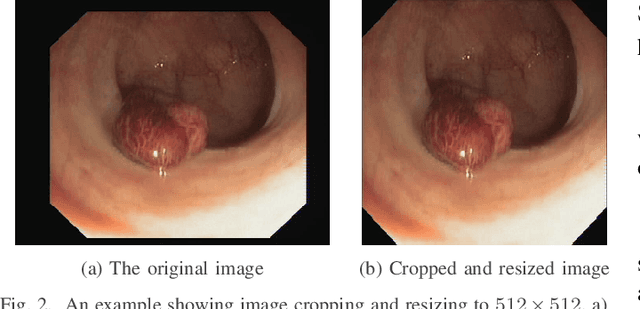 Figure 2 for Accurate Real-time Polyp Detection in Videos from Concatenation of Latent Features Extracted from Consecutive Frames