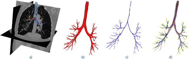 Figure 1 for Multi-site, Multi-domain Airway Tree Modeling (ATM'22): A Public Benchmark for Pulmonary Airway Segmentation