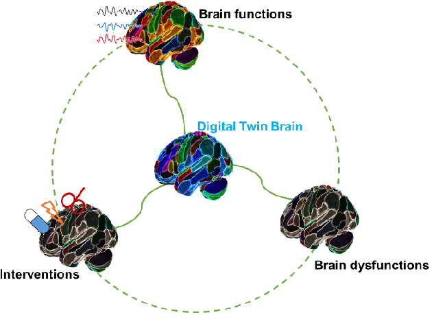 Figure 4 for Digital twin brain: a bridge between biological intelligence and artificial intelligence