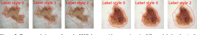 Figure 3 for That Label's Got Style: Handling Label Style Bias for Uncertain Image Segmentation