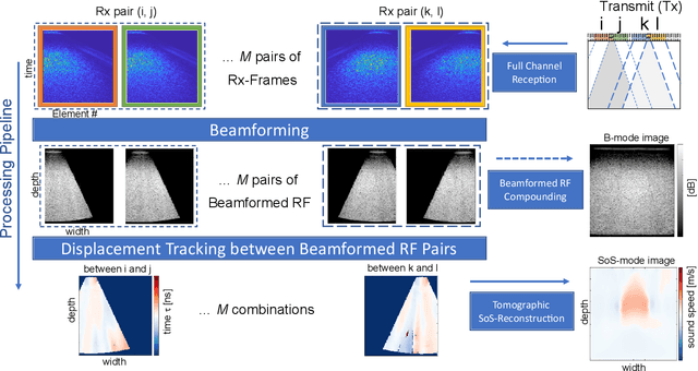 Figure 1 for Robust Imaging of Speed-of-Sound Using Virtual Source Transmission