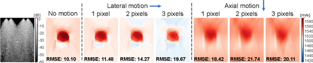Figure 2 for Robust Imaging of Speed-of-Sound Using Virtual Source Transmission