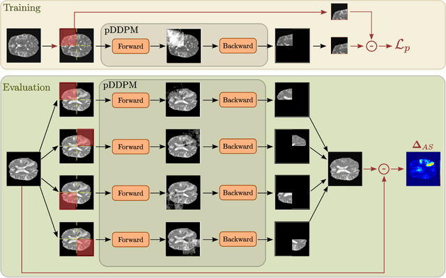 Figure 1 for Patched Diffusion Models for Unsupervised Anomaly Detection in Brain MRI
