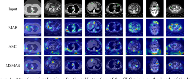 Figure 1 for Medical supervised masked autoencoders: Crafting a better masking strategy and efficient fine-tuning schedule for medical image classification