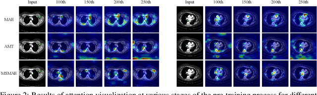 Figure 3 for Medical supervised masked autoencoders: Crafting a better masking strategy and efficient fine-tuning schedule for medical image classification