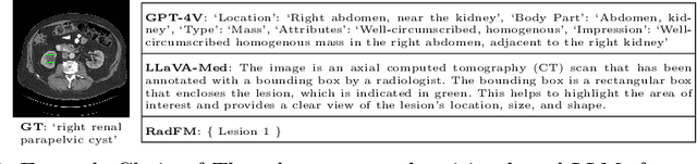 Figure 2 for Decomposing Vision-based LLM Predictions for Auto-Evaluation with GPT-4