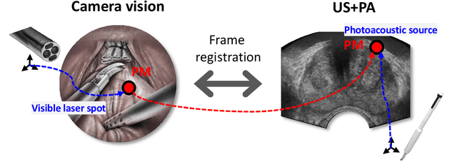 Figure 1 for Arc-to-line frame registration method for ultrasound and photoacoustic image-guided intraoperative robot-assisted laparoscopic prostatectomy