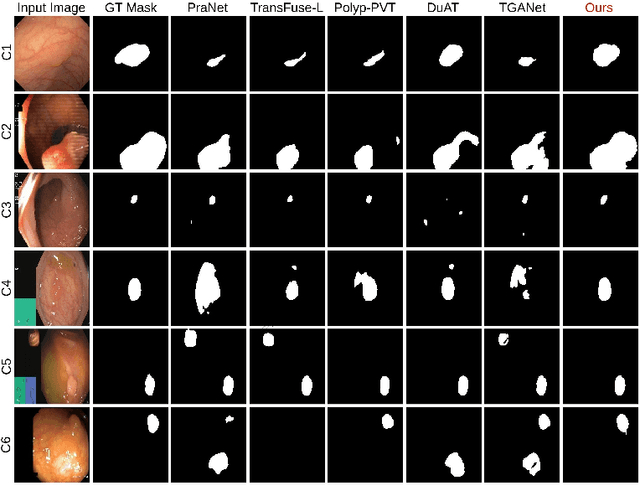 Figure 4 for Prototype Learning for Out-of-Distribution Polyp Segmentation