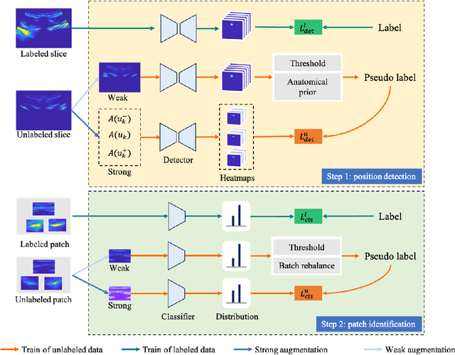 Figure 3 for VertMatch: A Semi-supervised Framework for Vertebral Structure Detection in 3D Ultrasound Volume