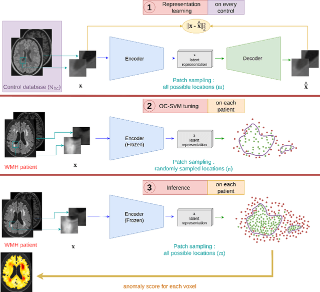 Figure 1 for One-Class SVM on siamese neural network latent space for Unsupervised Anomaly Detection on brain MRI White Matter Hyperintensities