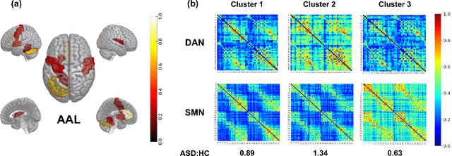 Figure 3 for Spatio-Temporal Attention in Multi-Granular Brain Chronnectomes for Detection of Autism Spectrum Disorder