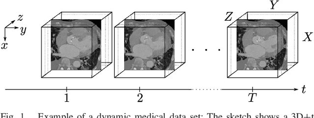Figure 1 for Graph-Based Compensated Wavelet Lifting for Scalable Lossless Coding of Dynamic Medical Data
