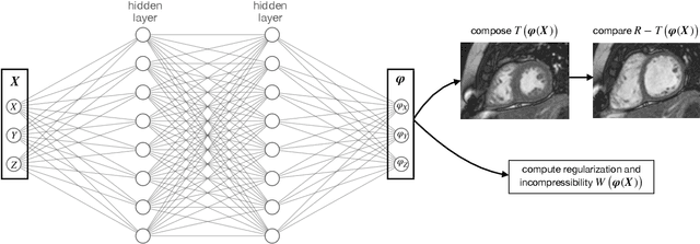 Figure 1 for WarpPINN: Cine-MR image registration with physics-informed neural networks