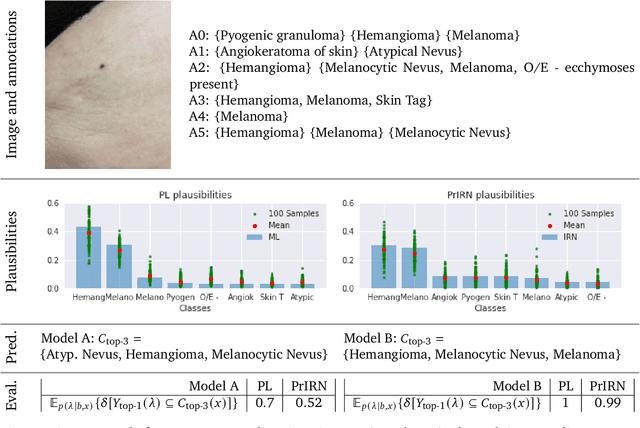 Figure 4 for Evaluating AI systems under uncertain ground truth: a case study in dermatology
