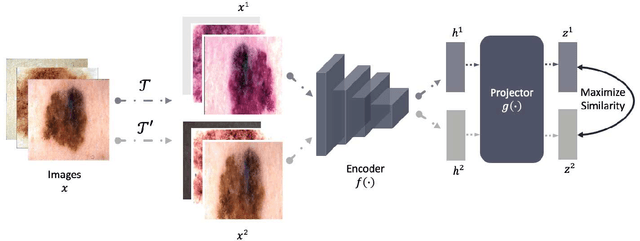 Figure 2 for Self-Supervised Multi-Modality Learning for Multi-Label Skin Lesion Classification