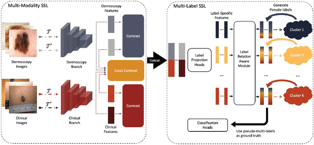 Figure 3 for Self-Supervised Multi-Modality Learning for Multi-Label Skin Lesion Classification