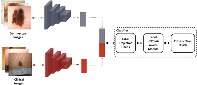 Figure 4 for Self-Supervised Multi-Modality Learning for Multi-Label Skin Lesion Classification