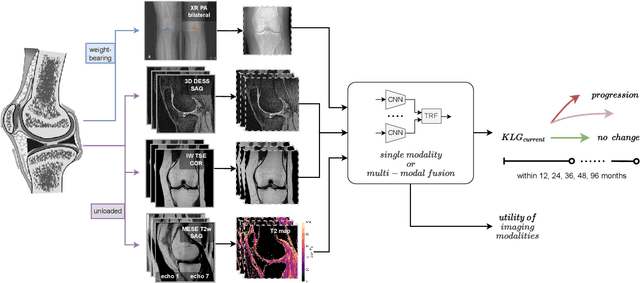 Figure 1 for End-To-End Prediction of Knee Osteoarthritis Progression With Multi-Modal Transformers