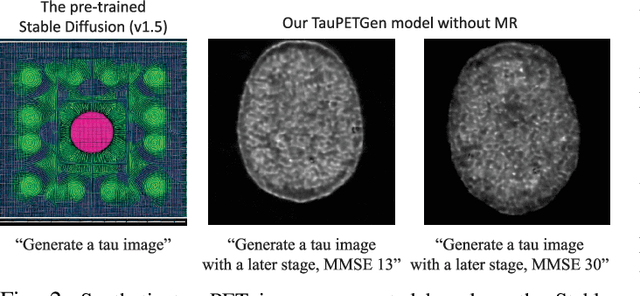 Figure 2 for TauPETGen: Text-Conditional Tau PET Image Synthesis Based on Latent Diffusion Models