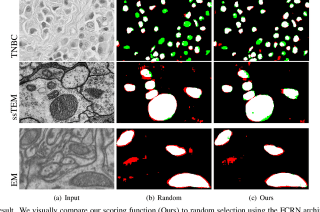 Figure 1 for Knowing What to Label for Few Shot Microscopy Image Cell Segmentation