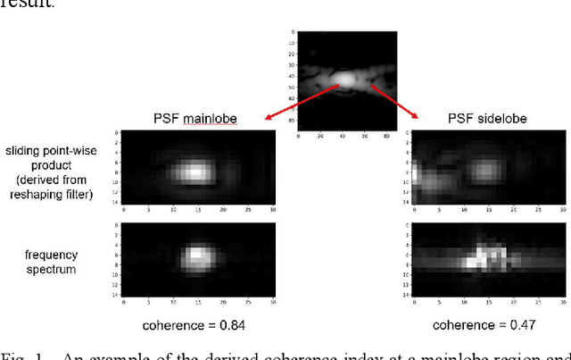 Figure 1 for Phase Aberration Correction with Adaptive Coherence-Weighted Point Spread Function Restoration Filtering Technique