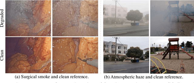 Figure 1 for Self-Supervised Video Desmoking for Laparoscopic Surgery