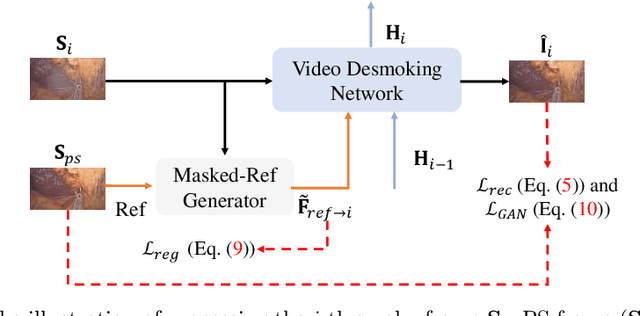 Figure 3 for Self-Supervised Video Desmoking for Laparoscopic Surgery