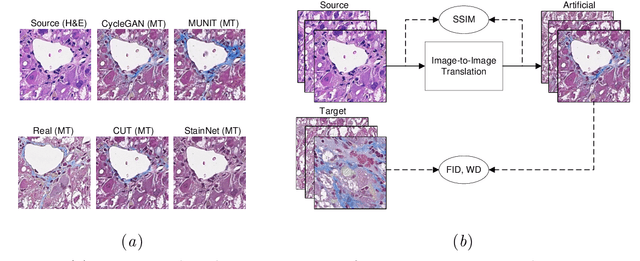 Figure 1 for A comparative evaluation of image-to-image translation methods for stain transfer in histopathology