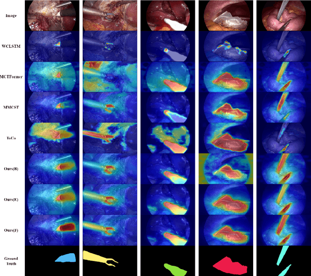 Figure 3 for WeakSurg: Weakly supervised surgical instrument segmentation using temporal equivariance and semantic continuity