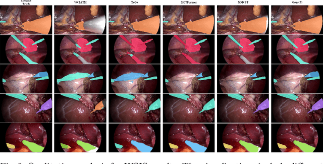 Figure 4 for WeakSurg: Weakly supervised surgical instrument segmentation using temporal equivariance and semantic continuity