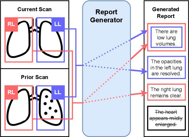 Figure 1 for Controllable Chest X-Ray Report Generation from Longitudinal Representations