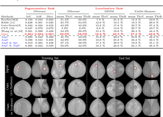 Figure 4 for DisAsymNet: Disentanglement of Asymmetrical Abnormality on Bilateral Mammograms using Self-adversarial Learning